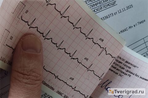 Сердце бьётся в ритме оливок: почему кардиологи единогласно выбирают средиземноморскую диету